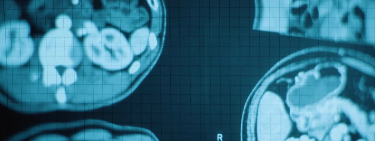 Close up of various scan images of the head and neck displayed on a screen