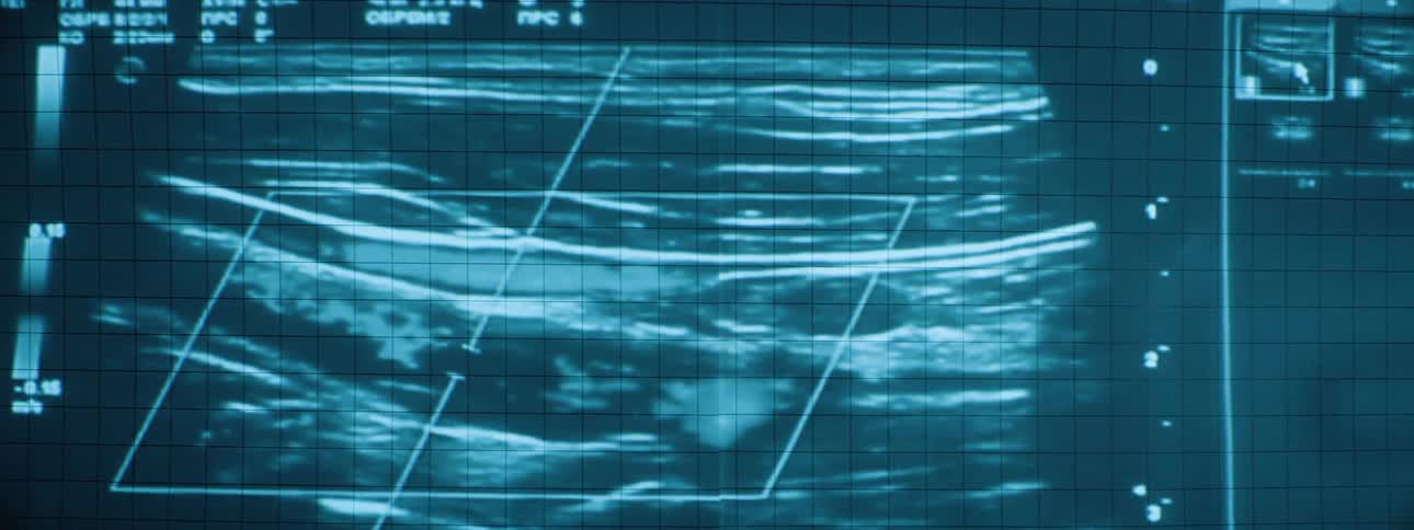 Medical imaging is displayed as a projection on the wall