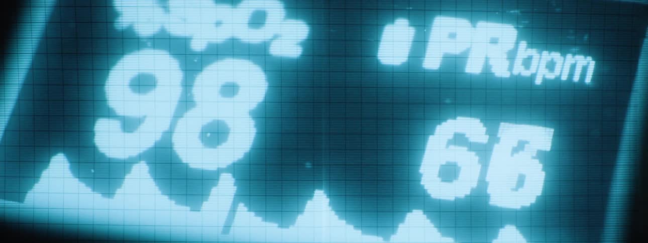 A medical monitor displays vital signs in bright cyan against a dark background showing an spo2 reading of 98 and a pulse rate of 69 bpm along with a fluctuating waveform