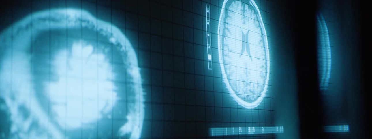 A ct scan is projected on the wall