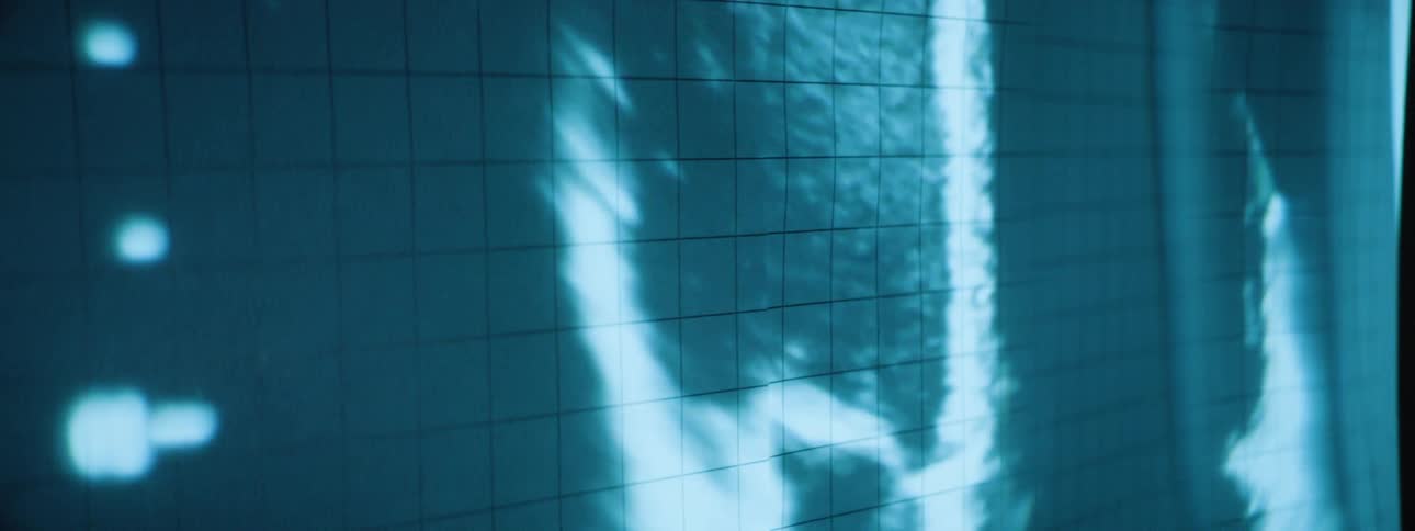 An ultrasound image displayed on a screen