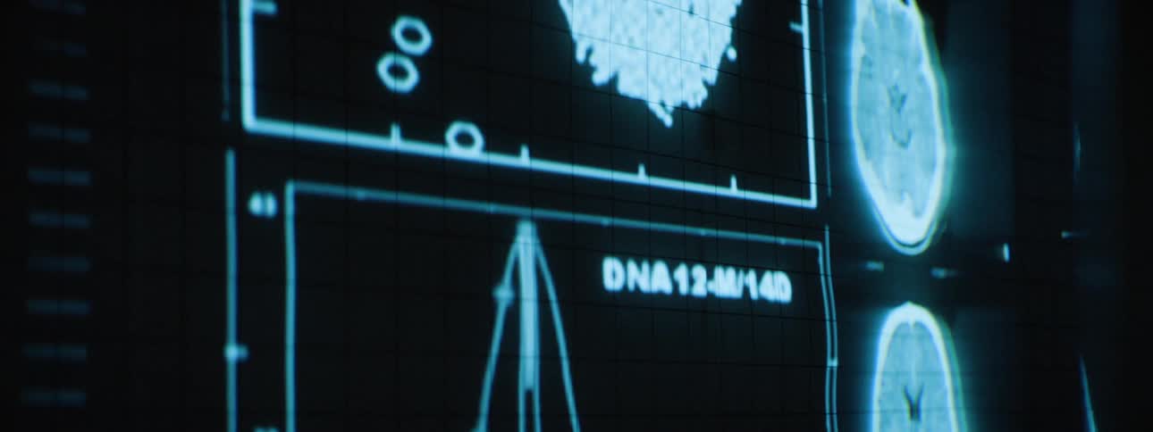 Closeup of a futuristic medical display showing brain scans data graphs and anatomical analysis