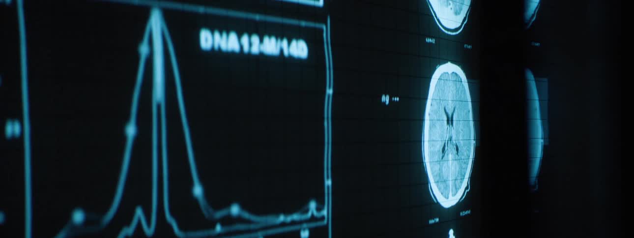 Different types of data and graphs are being displayed on a monitor