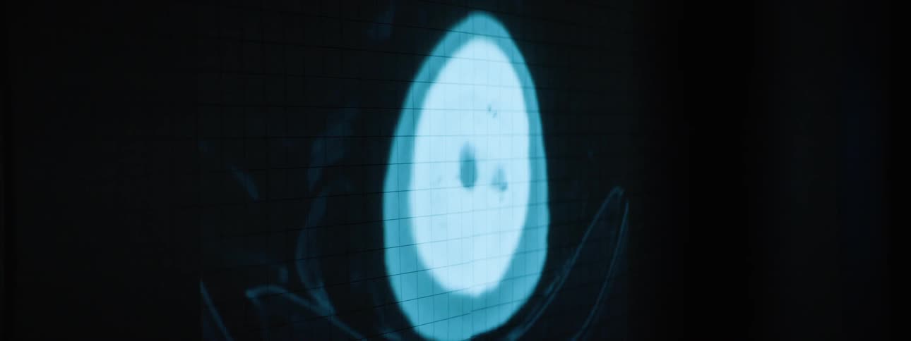 A projection of medical imaging is on the dark wall