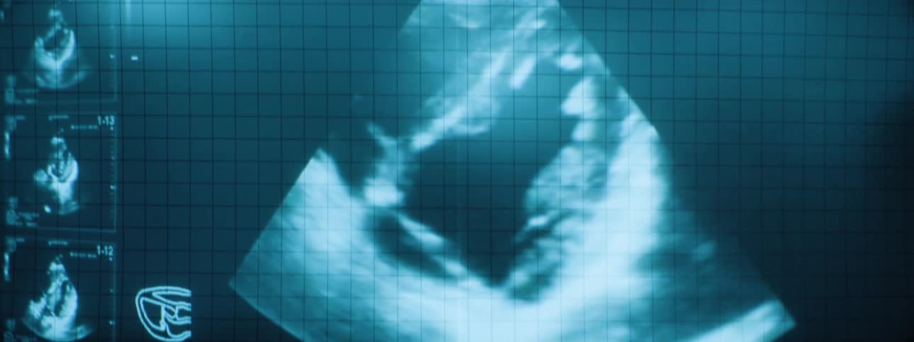A medical ultrasound screen displays a dynamic grayscale image of a beating human heart within a grid framework accompanied by diagnostic icons and labels