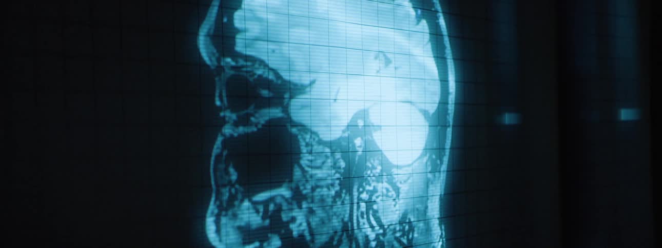 A display of medical imaging is projected on the wall