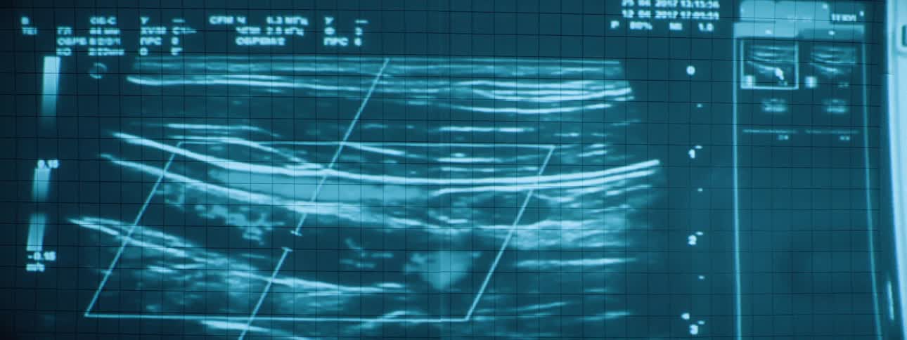 Medical imaging is projected on the wall in the dark