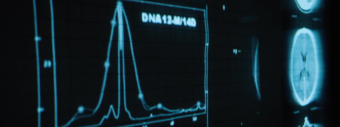 Medical imaging and charts are projected on the dark wall
