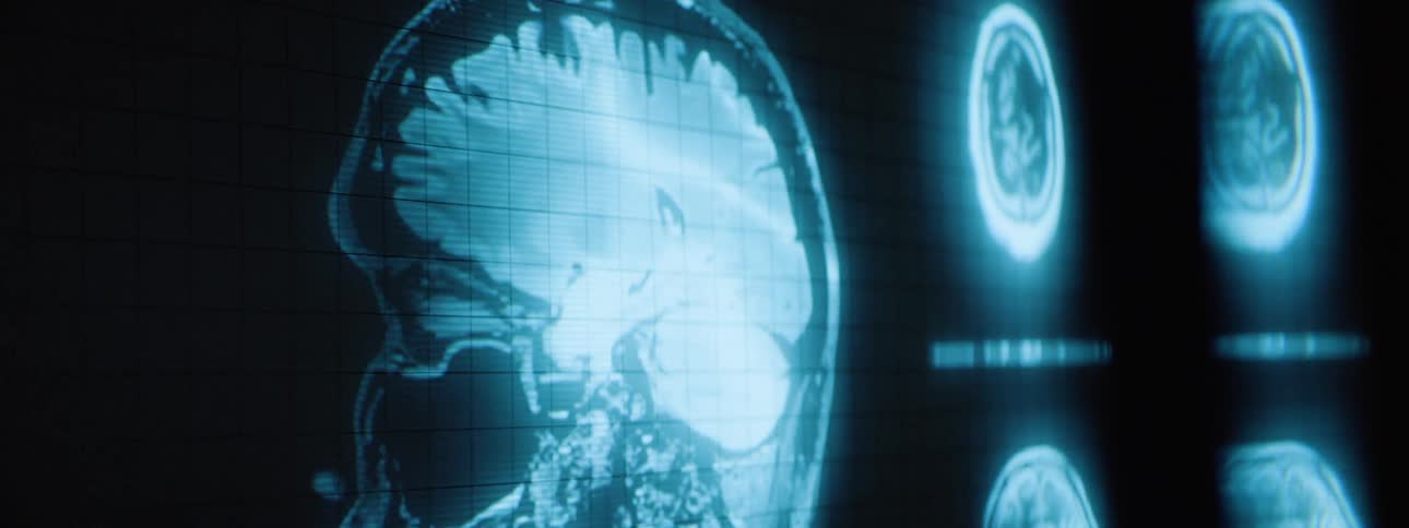 A ct scan of a persons head