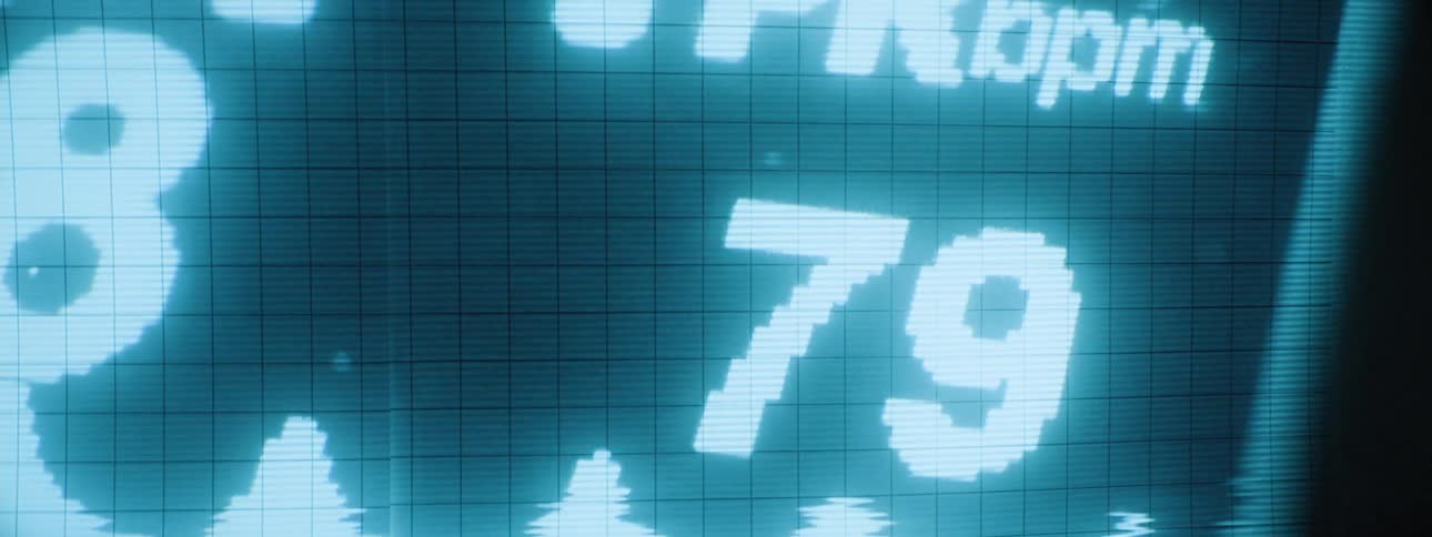 A monitor displaying heartbeats