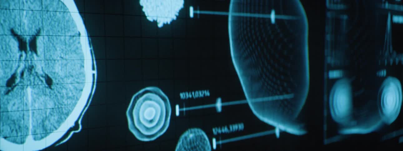 A screen of a brain scan