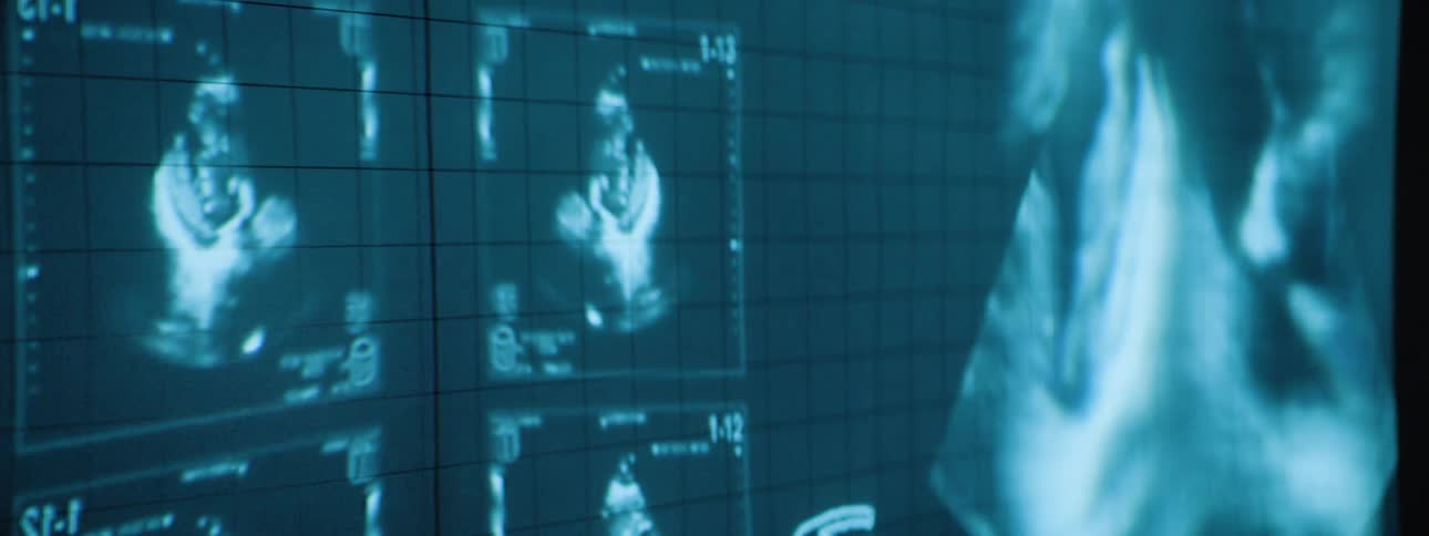 A dimly lit medical monitor displays multiple small ultrasound images possibly of a fetus alongside a larger more detailed ultrasound view all in shades of blue against a dark gridded background