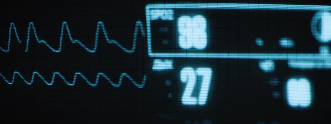 A medical device showing heartbeat information