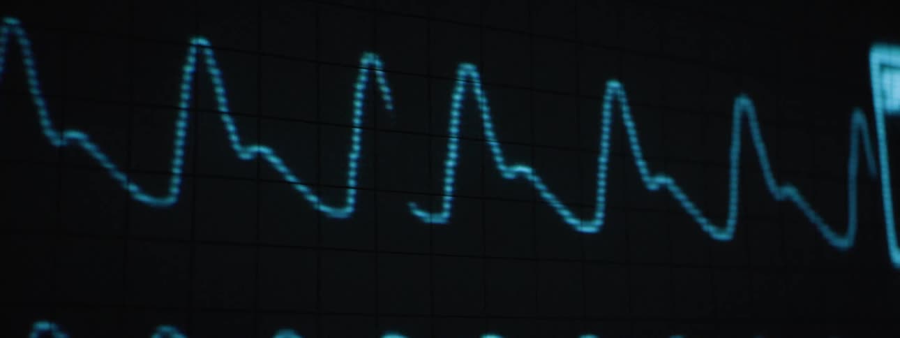 A blue graph on a black screen