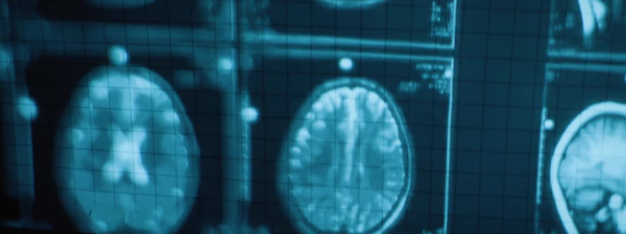 A large group of ct scans of a head are projected on the wall