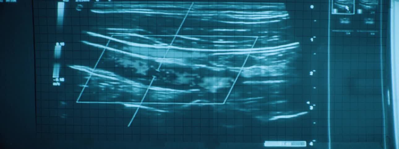 A bluetoned medical monitor displays a sonogram image with a grid measurements and abstract internal structures