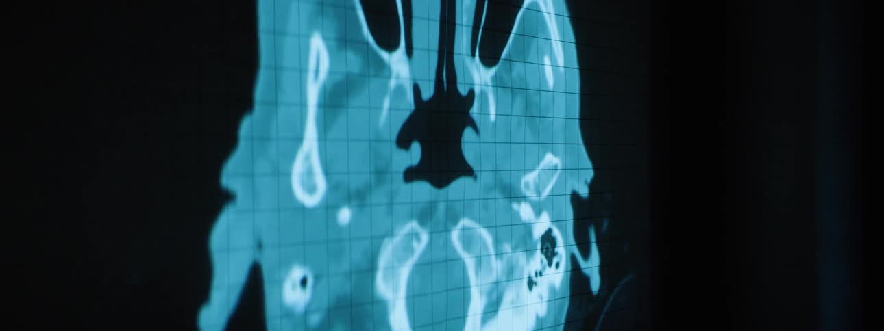 A ct scan of a persons head