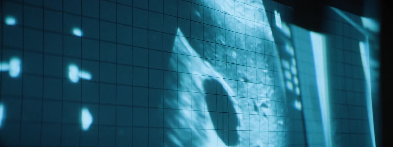 A bluetoned medical screen displays a sonogram image with grid lines and bright abstract shapes