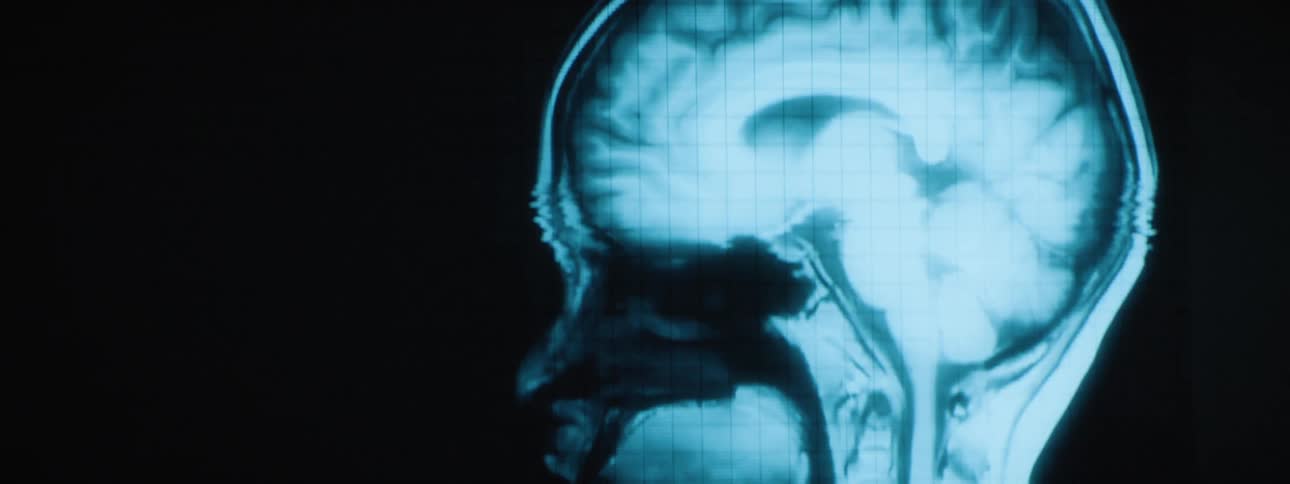 Digital medical imaging scan of a persons brain