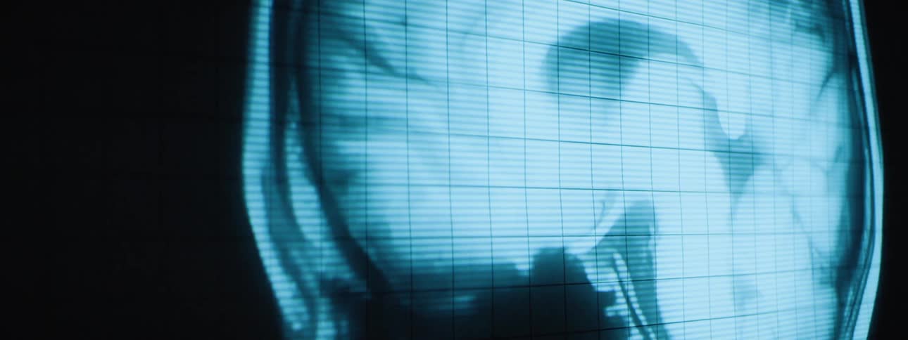 A medical scan is displayed on a screen in blue