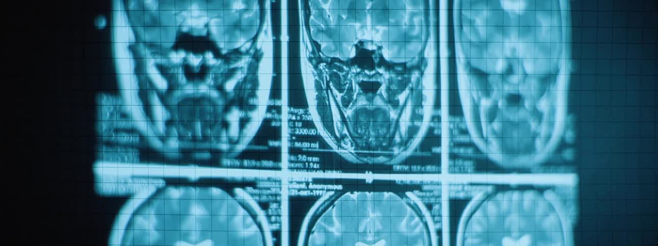 A tealtoned xray and ct scan images displays parts of the human body visible against a gridded background
