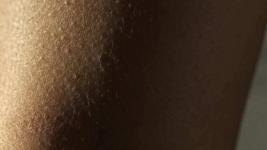 A closeup reveals human skin with goosebumps and fine hairs illuminated by light from the upper left