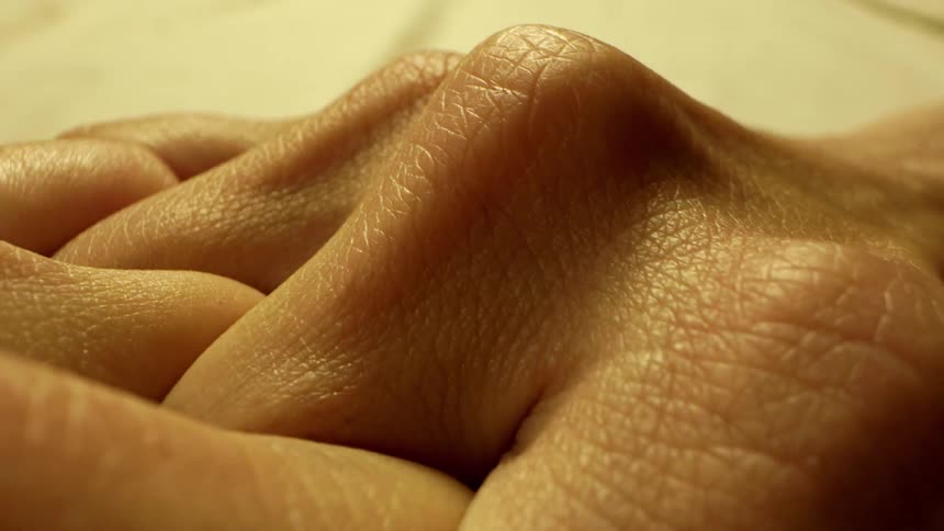 A persons arm with dry skin fingers interlocked with the other arm in a resting position