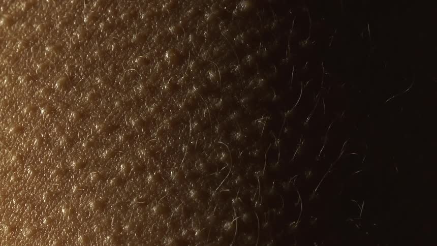 A persons skin covered with goosebumps