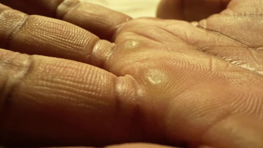 The dryskinned palm and fingers of a black person are shown under the bright midday sun