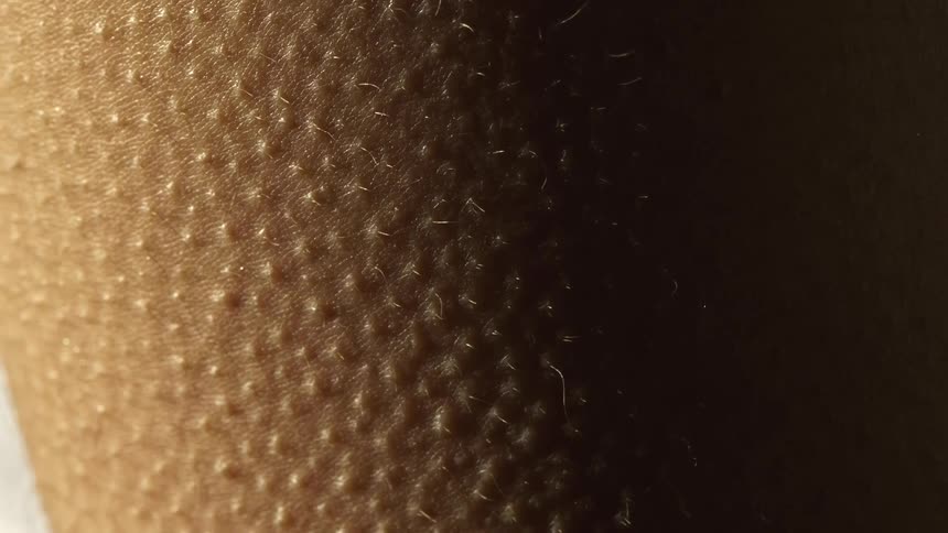 Goosebumps form on the persons skin