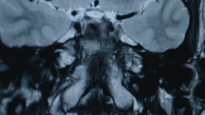 A medical scan image changes and forms