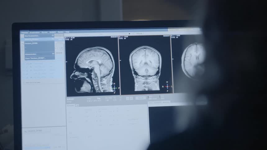 A person looks at scan results on a computer screen