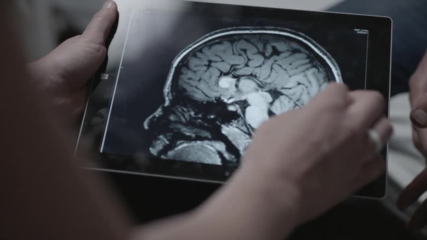 A person is examining an image of a head scan