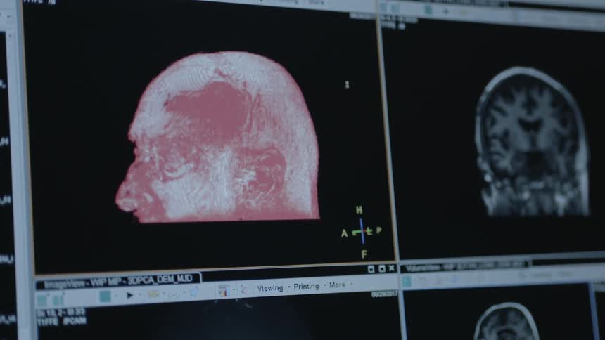 A 3d scan of a human head rotates on a monitor