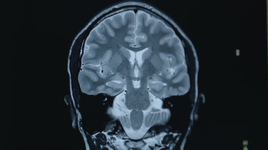 Computer generated image of a person's head