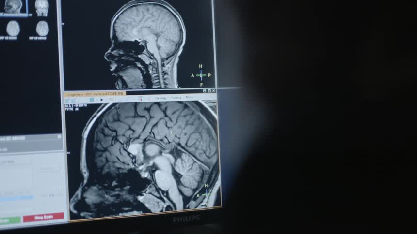 Medical images of a brain on a monitor