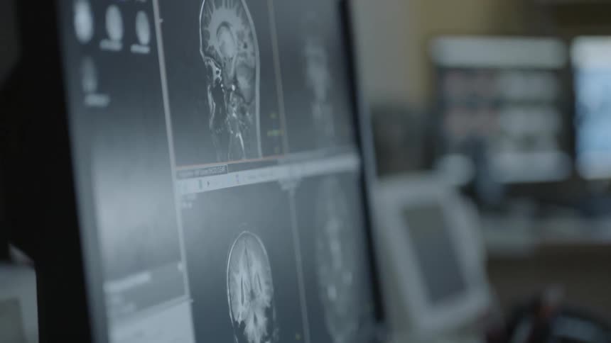 Medical images on a monitor