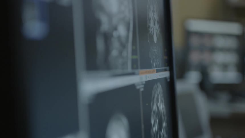 Close up of images of brains