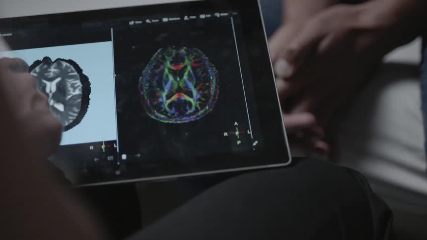 A person is pointing to brain scan images on a tablet
