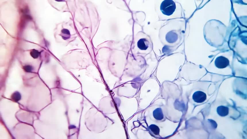 A closeup of stained plant cells arranged in an interconnected grid like pattern showing distinct cell walls and darkstained nuclei