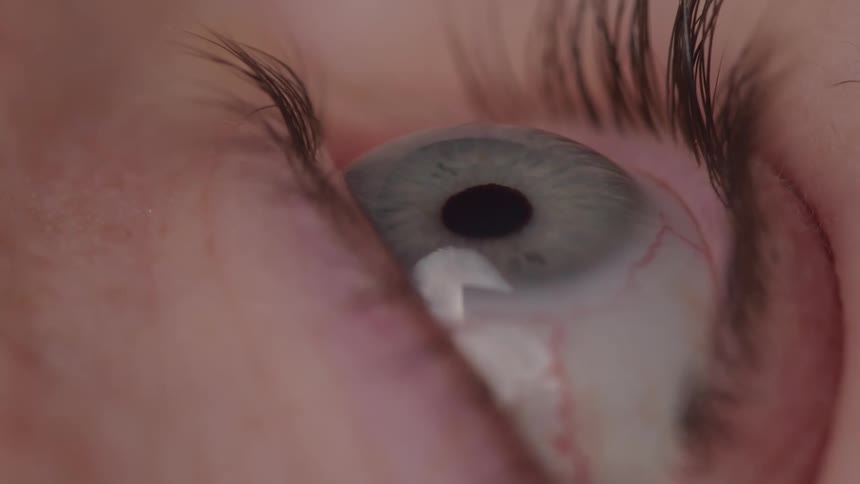 The person blinks their eye slowly