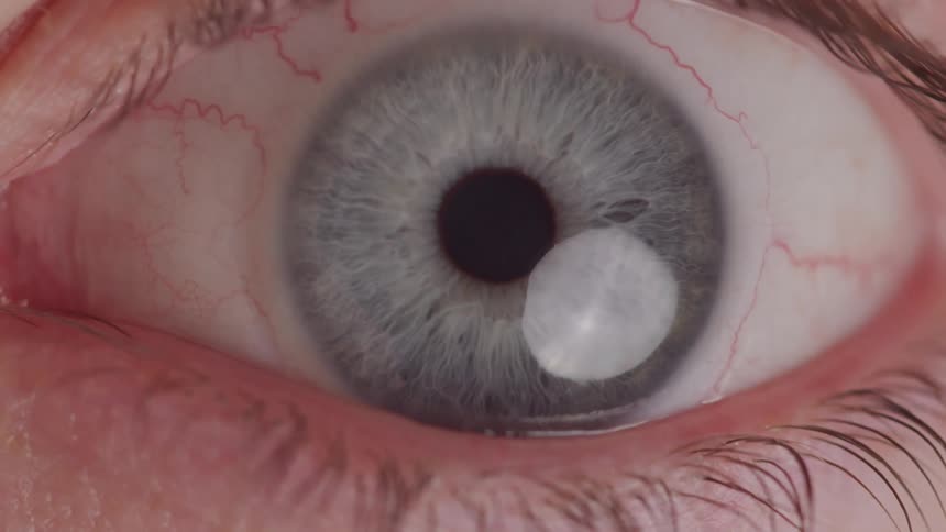 Extreme close up of a persons eyelid opening revealing blue eyes