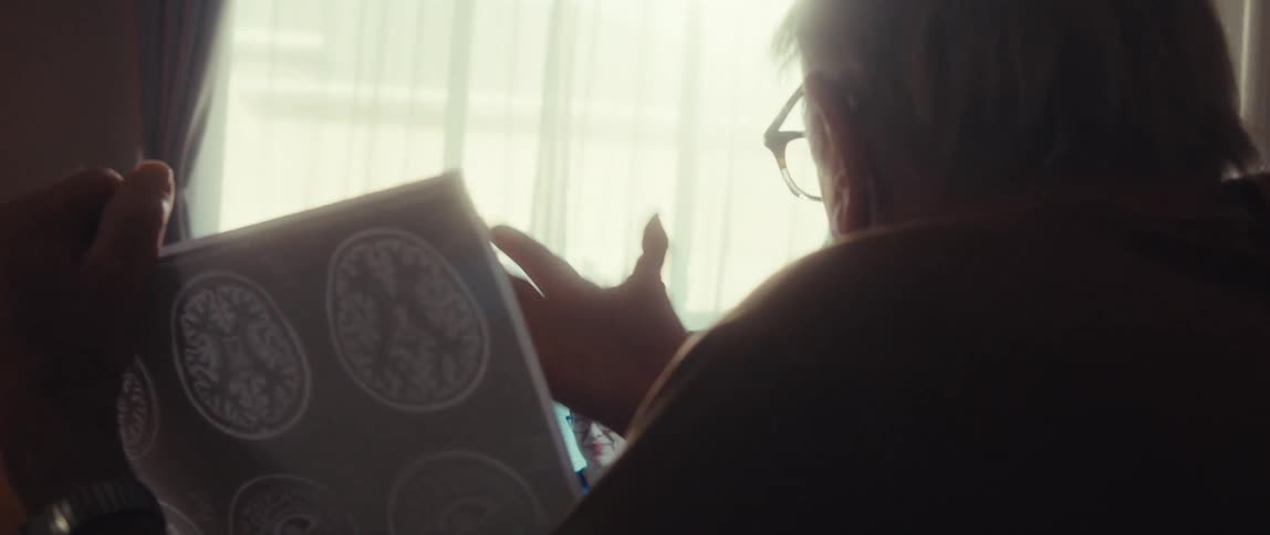 An older man at home holds up his brain scans while talking to his doctor on a video call
