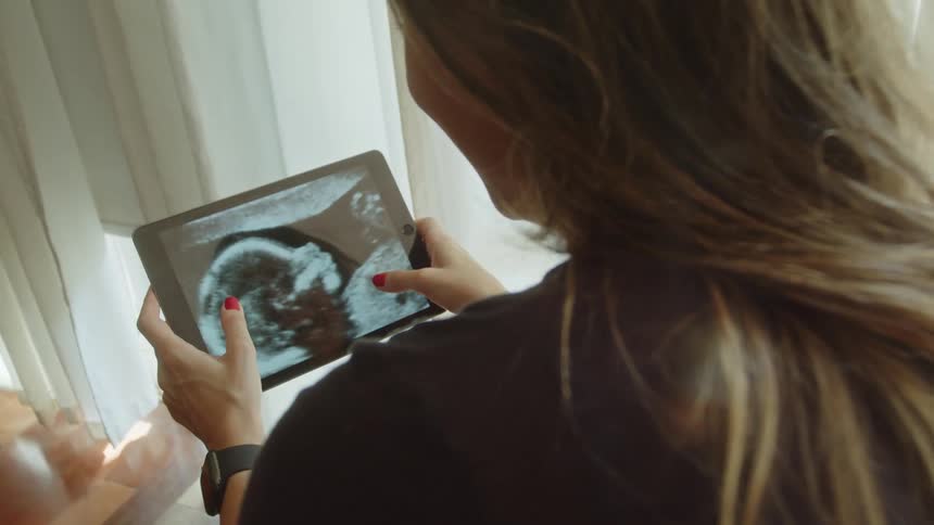 The woman touches the screen of the tablet that is showing an ultrasound