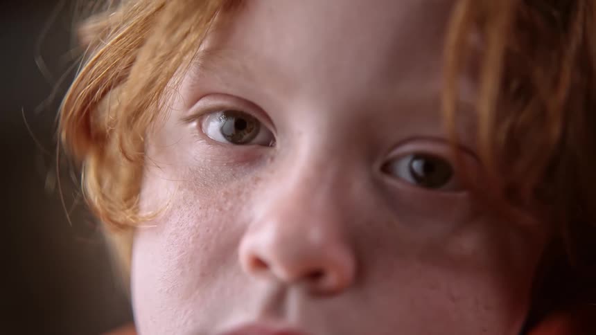 A boy with red hair and light skin looks directly forward with brown eyes showing freckles on the nose and cheeks