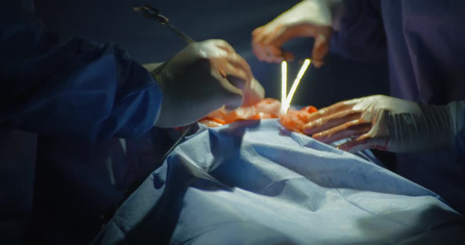 Hands of professional doctors performing surgery with instruments