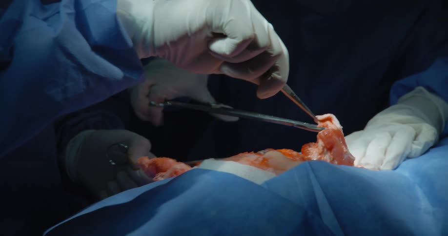 The surgeon is cutting into the patient