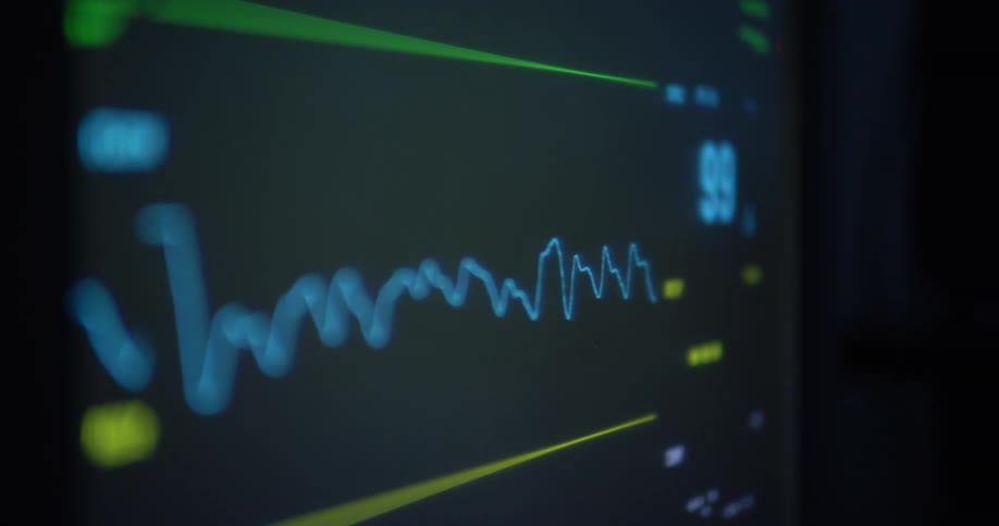 Close up of a monitor screen displaying a patients vital signs in the hospital