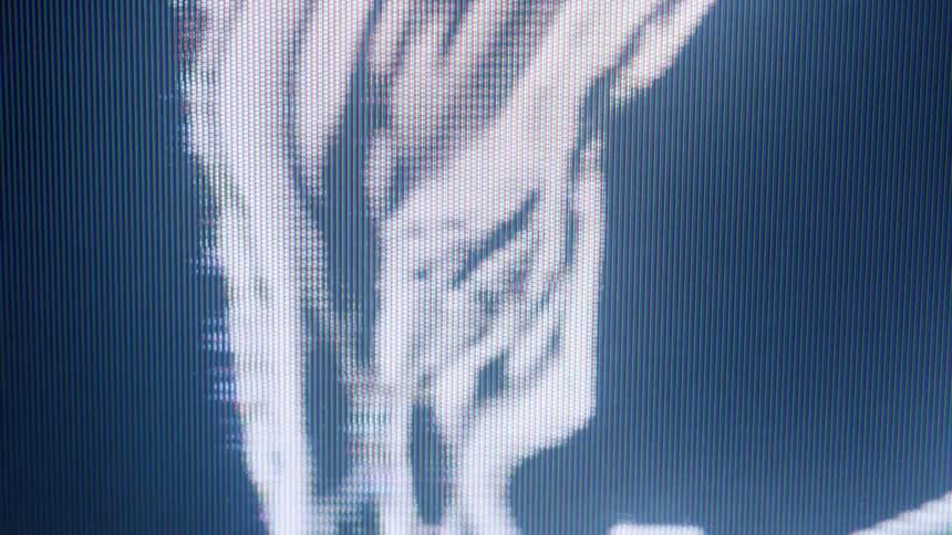 Medical imaging on a black and white screen