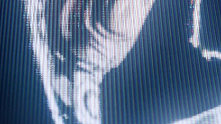 A digital scan or x ray displayed on a screen